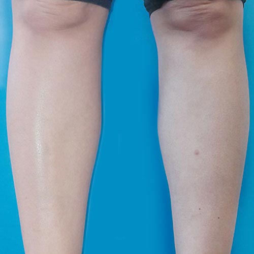 venus velocity 8 after