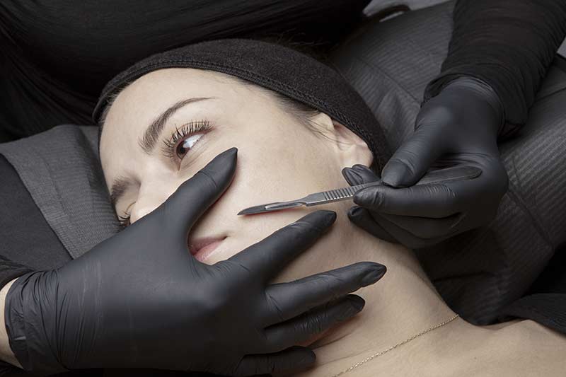 dermaplaning face dermaplaning face