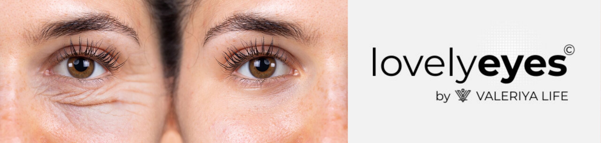 Non-Invasive Treatments