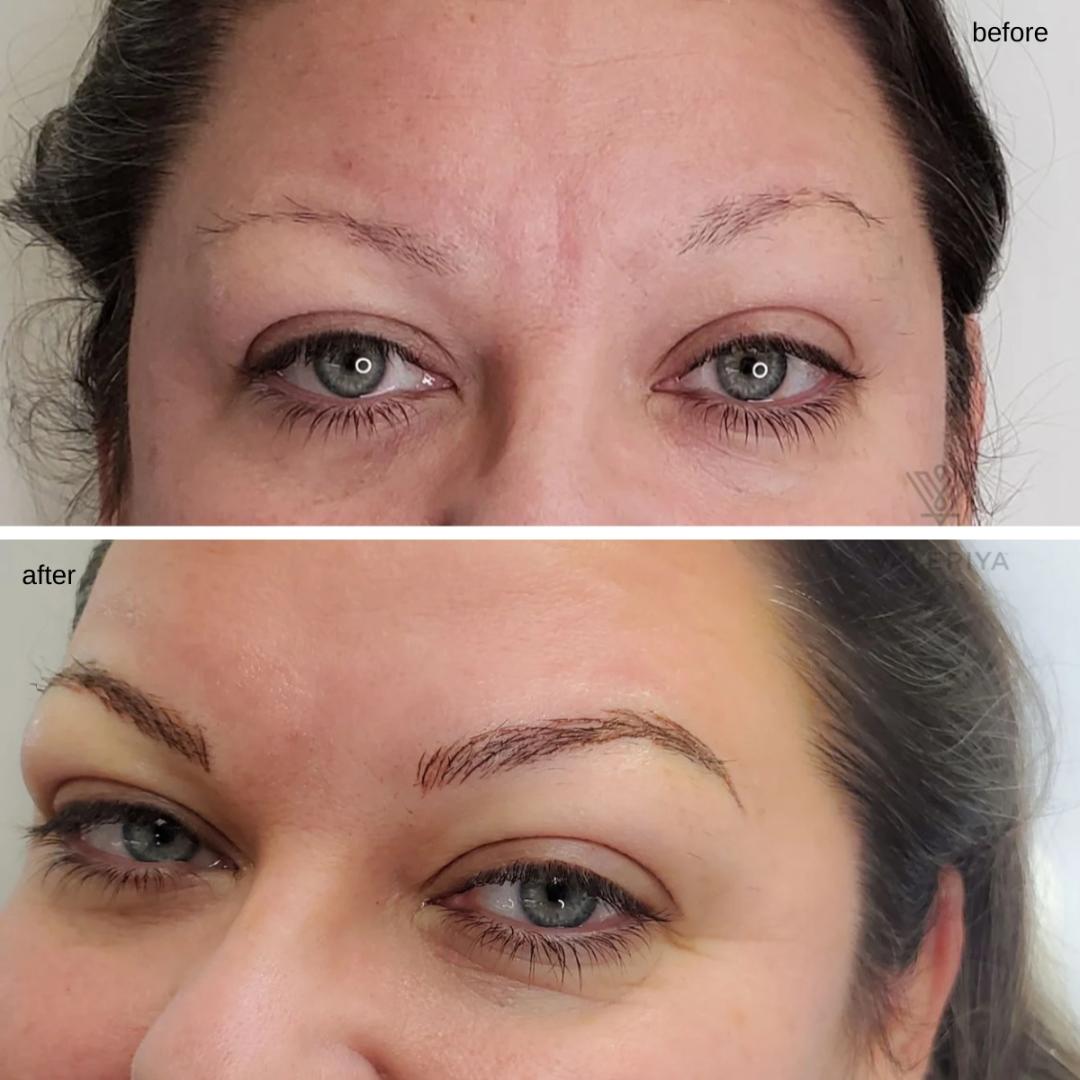Microblading
