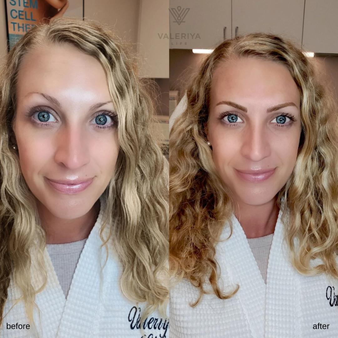 Side-by-side before-and-after photo of a woman with long, wavy blonde hair wearing a white robe. The logo on the robe shows a "Valeriya Life" branding.