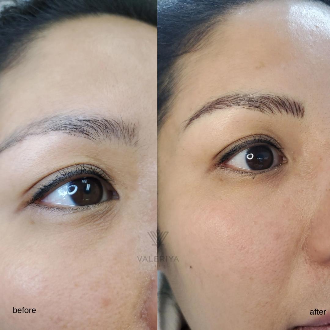 Microblading